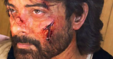 A bloody and bruised Rahul Bhat shoots for his next Netflix project